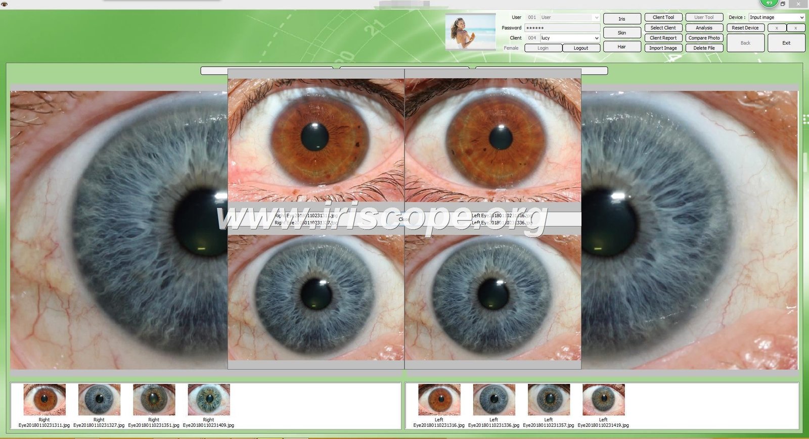 Lente de cámara para iridología