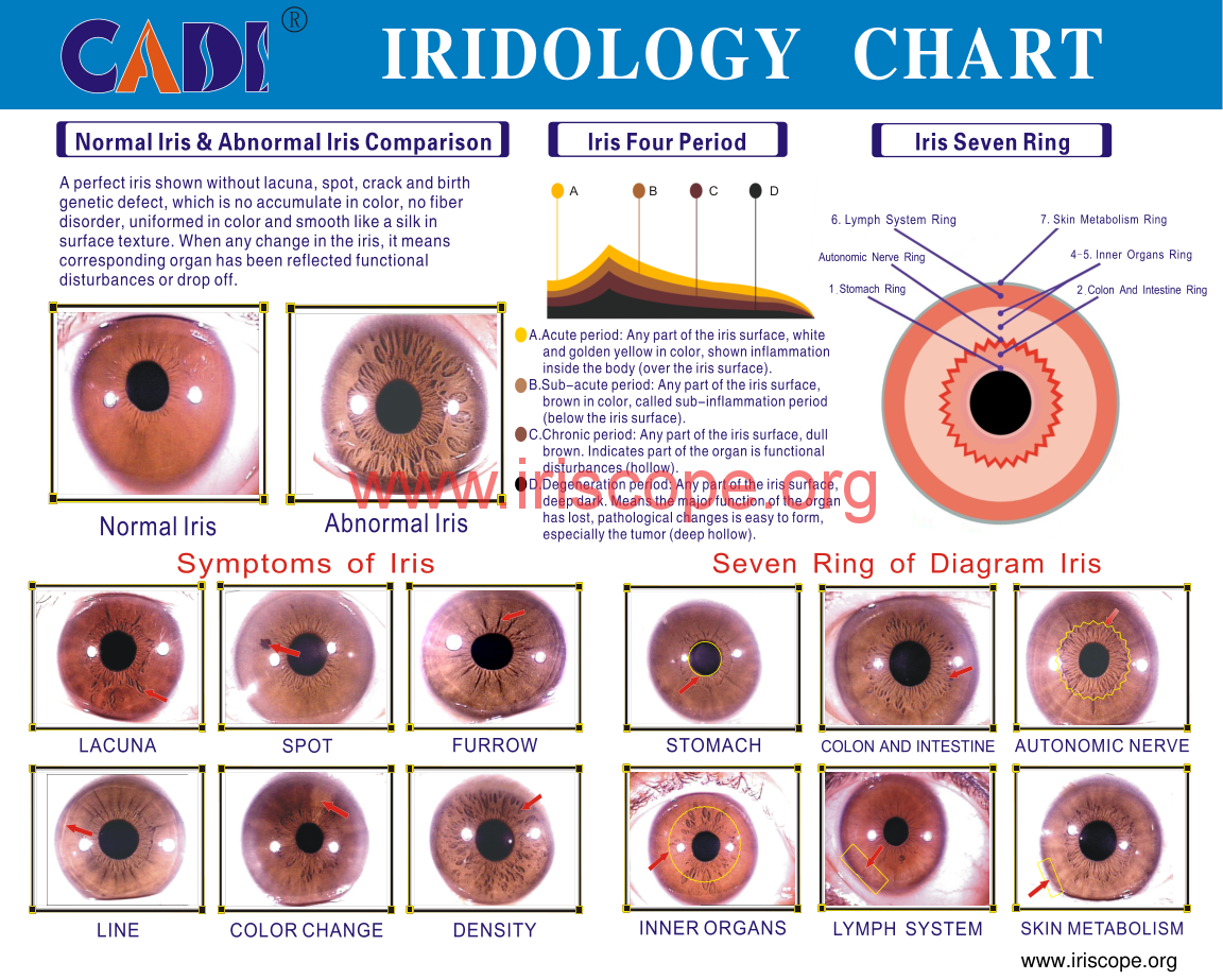 MAIKONG Iridology Camera and Software