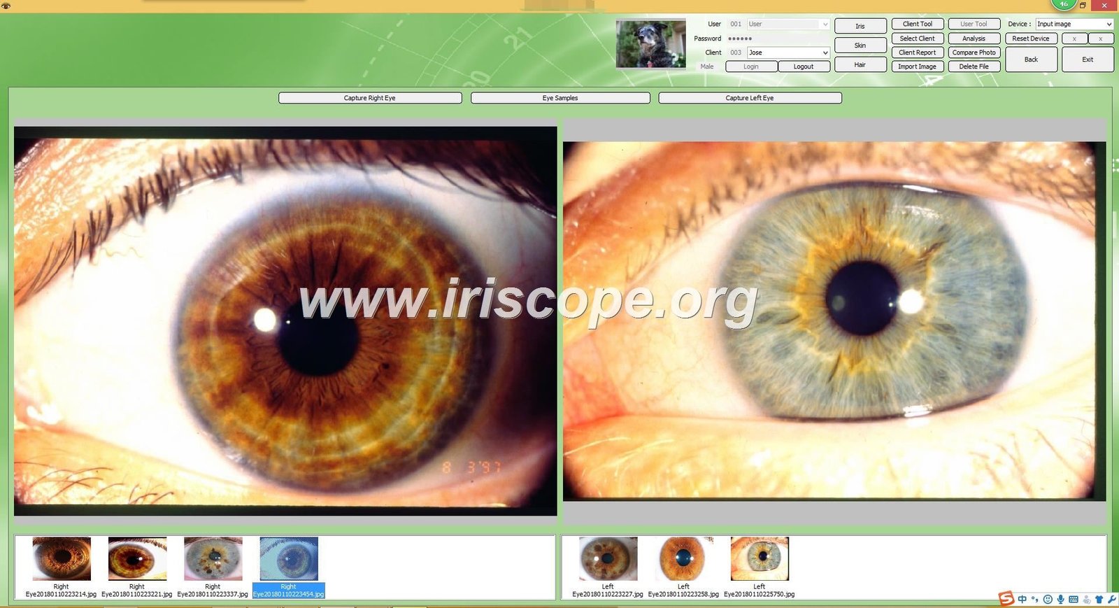 MAIKONG Iridology Camera Stand
