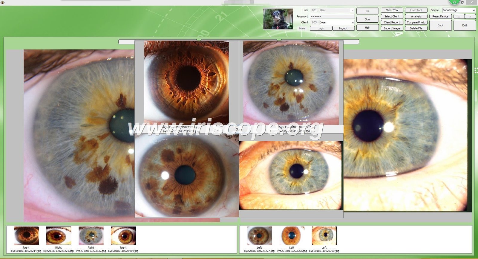 MAIKONG Iridology Camera Stand
