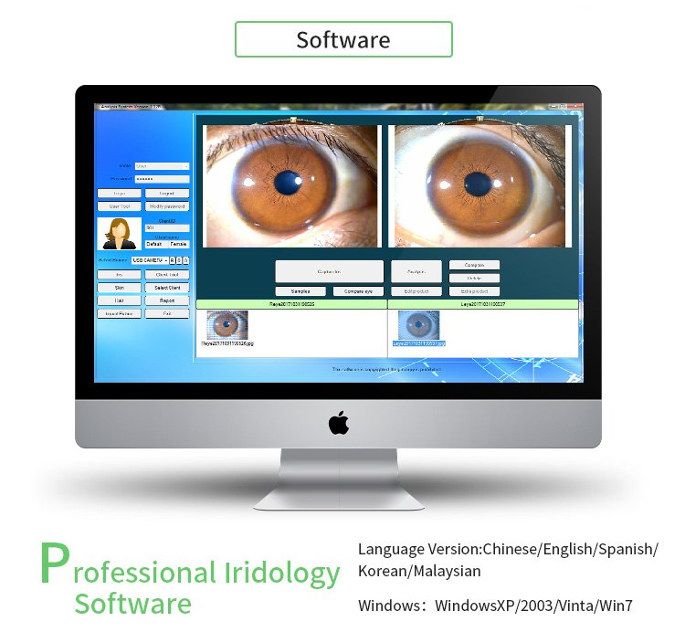 MAIKONG Iridology Camera and Software