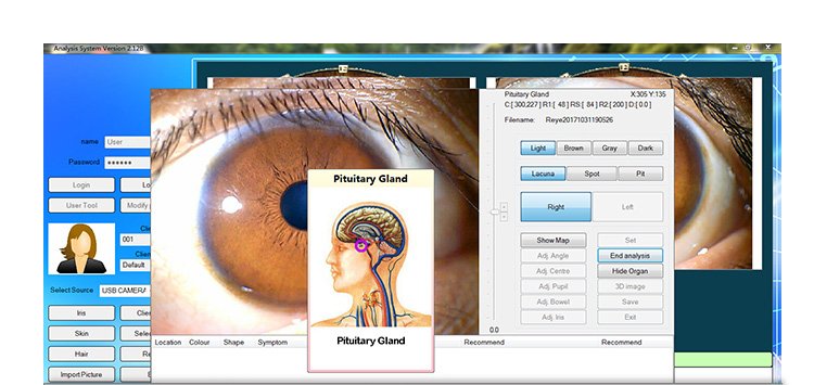 MAIKONG Iridology Camera and Software